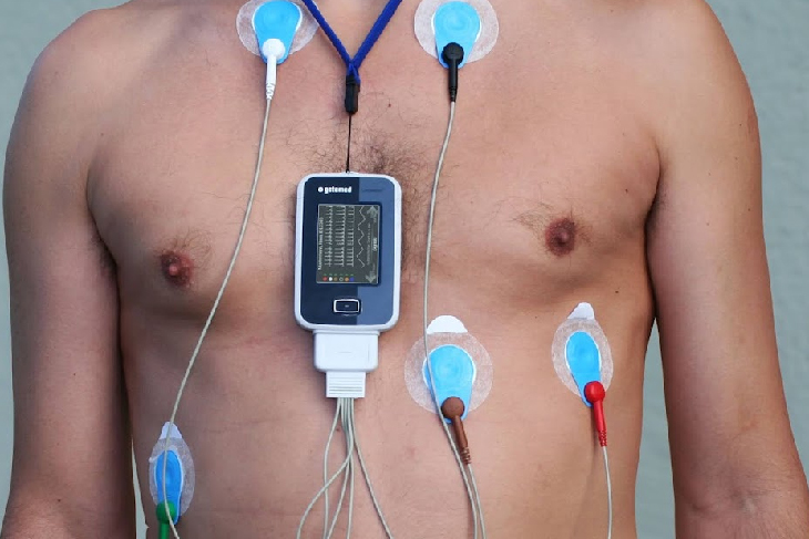 A Holter monitor